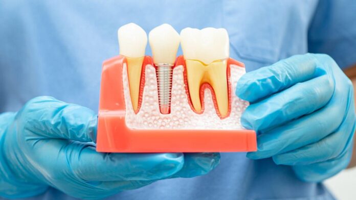 Is It Painful to Extract a Root Canal Tooth