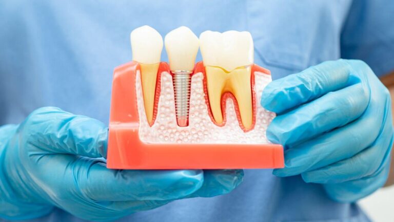 Is It Painful to Extract a Root Canal Tooth